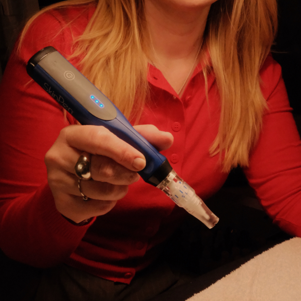 Skinpen Microneedling