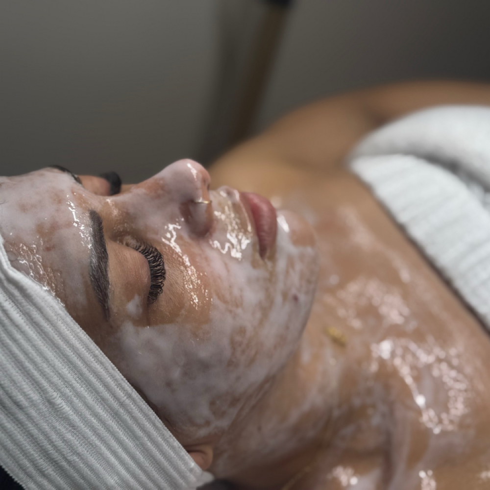 Acne Facial at Marta Rabelo Skin & Laser in Malden, MA