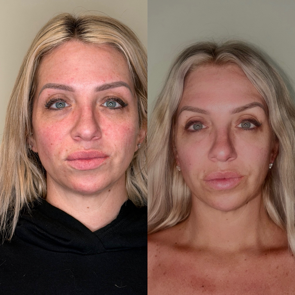 Egyptian Rose Facial at Efflorescence spa in Oakmont, PA