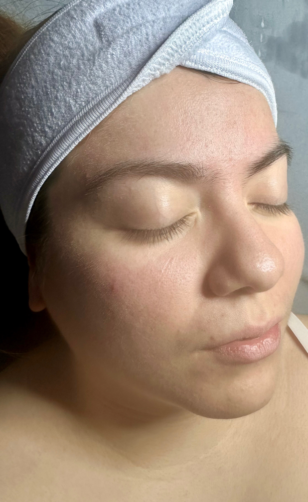 Signature Facial at Bellissima Skin & Beauty in Madison, WI