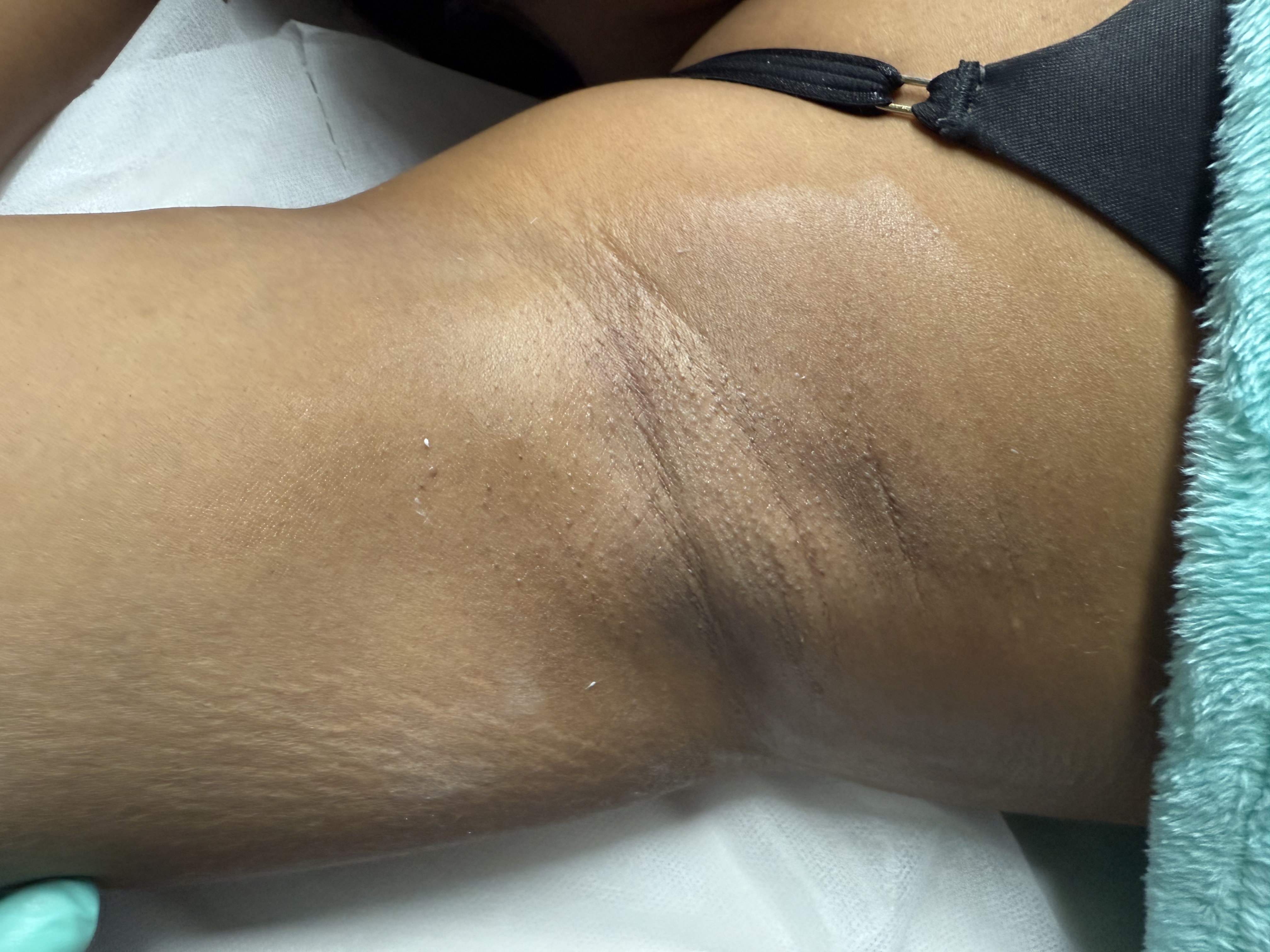 Underarm Wax
