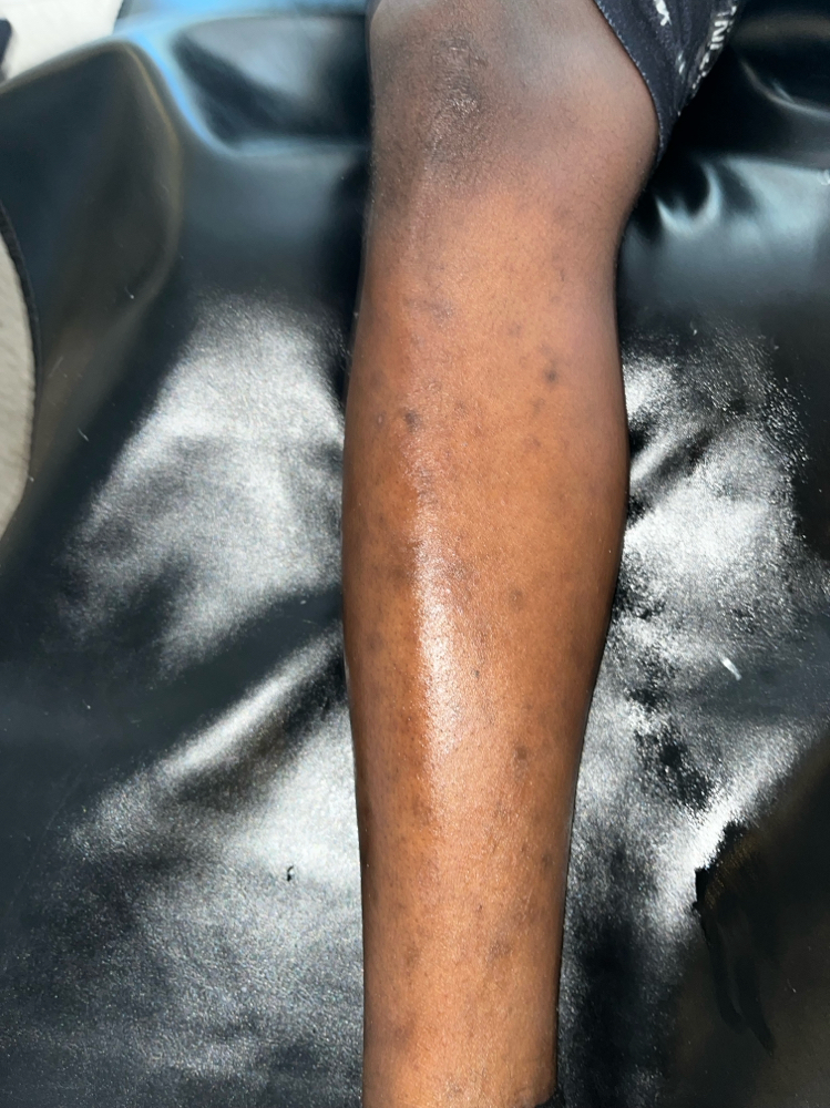 1/2 Leg Hair Removal