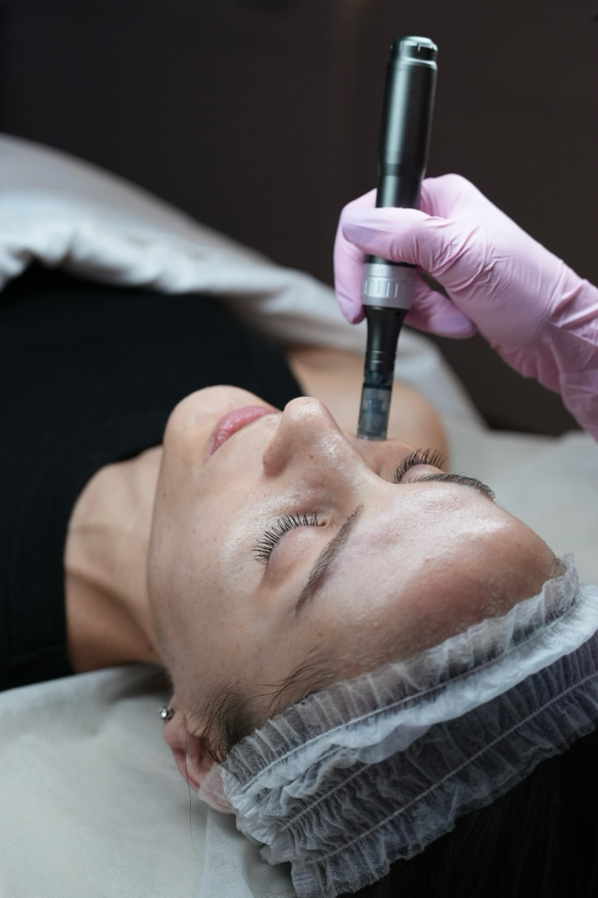 Microneedling