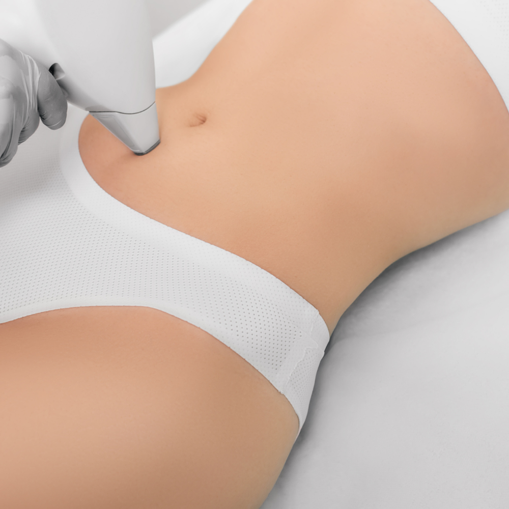 6 Sessions Abdomen Laser