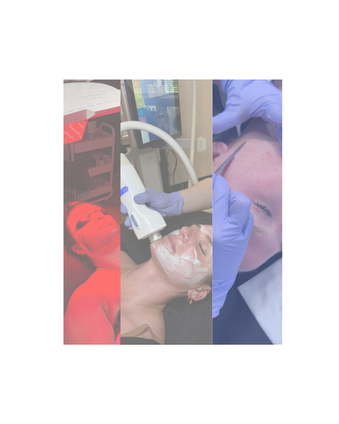 Firework Facial