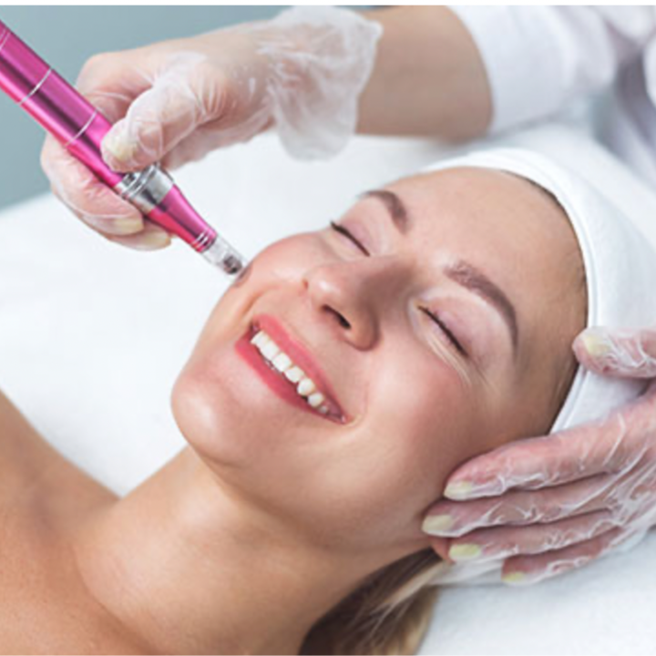 Nano Needling at PNW BEAUTY in Roseburg, OR