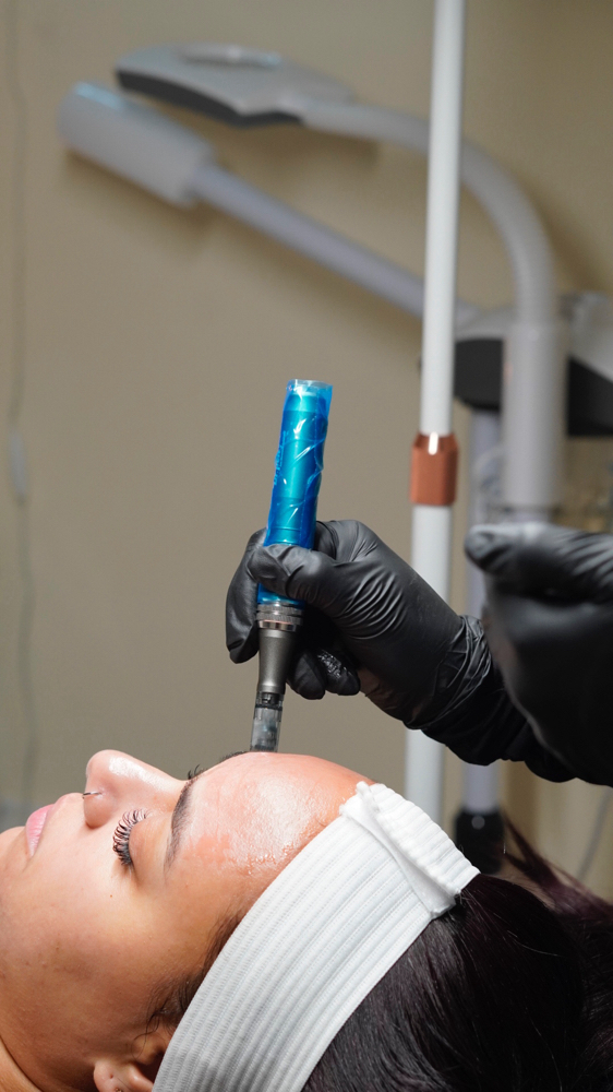 New Client Microchanneling Facial