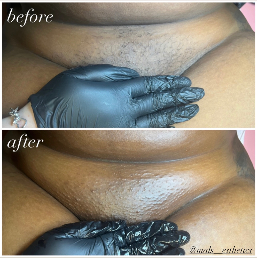 Brazilian Wax