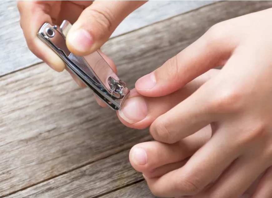 Toe Nail Trim