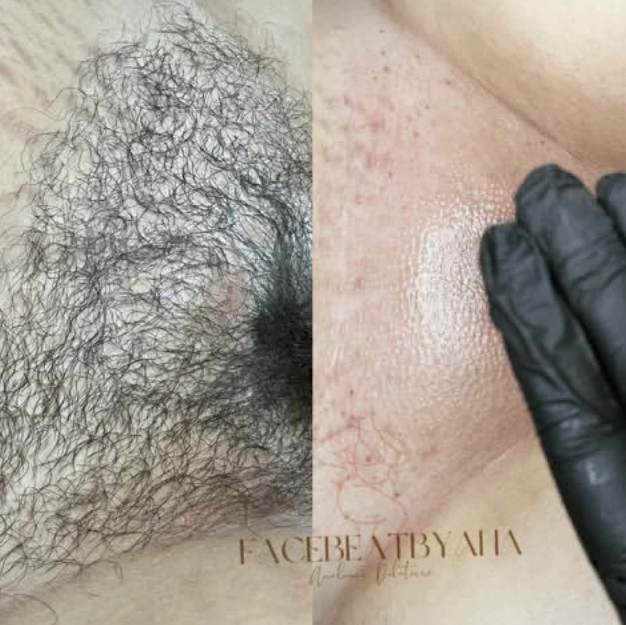 Brazilian Wax