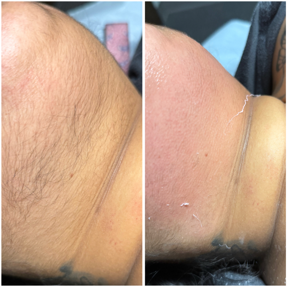 Chin /lip Wax at Virgostouch in Houston, TX