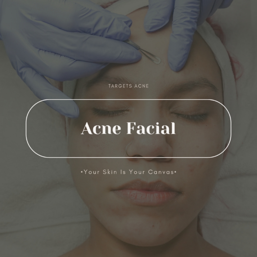 Acne Clearing Facial at Face Palette Aesthetics in Franklin, WI