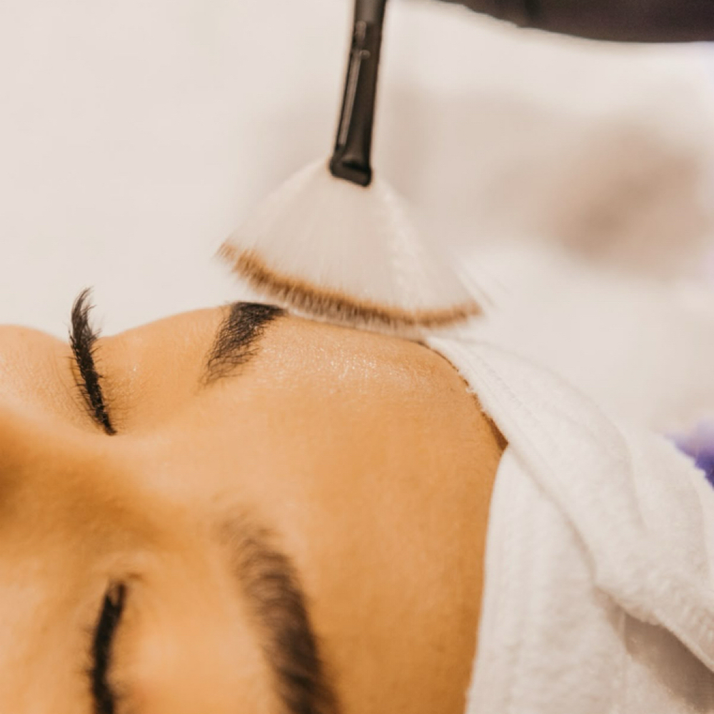 Lactic Acid Chemical Peel at Bare Esthetics Medical Spa LLC in Idabel, OK