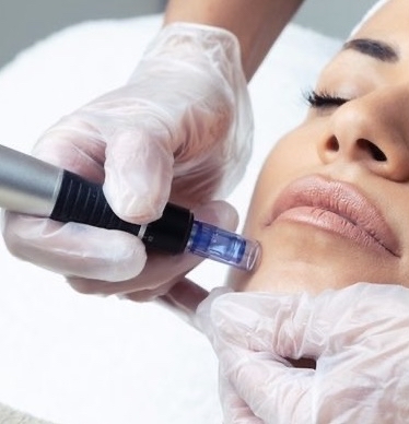 Nano Needling Facial