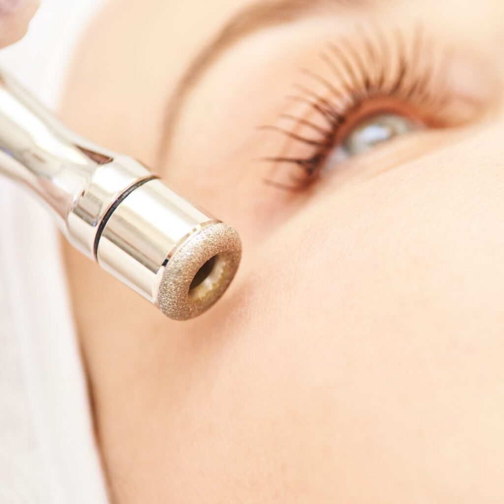 ADD-ON SERVICE: Microdermabrasion