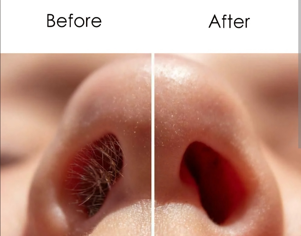 Nose Wax