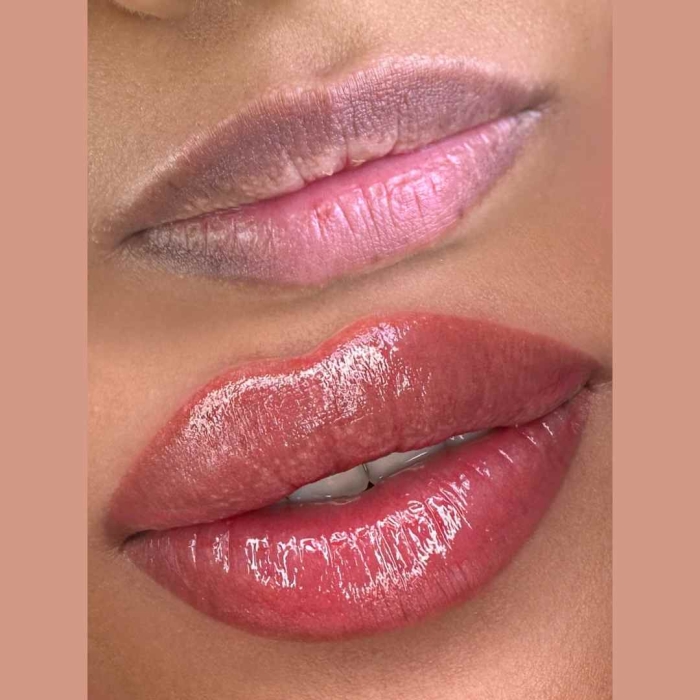 Dark Lip Neutralization