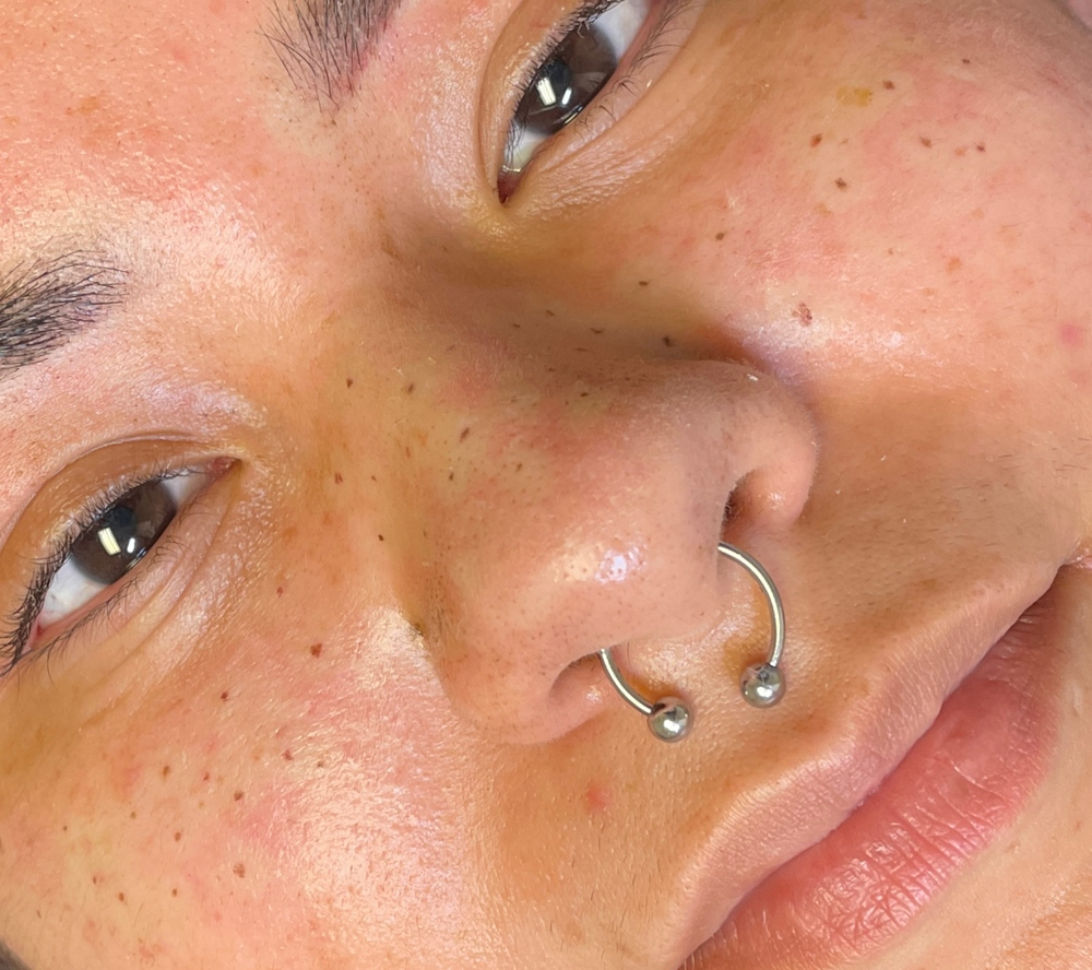 Faux Freckles