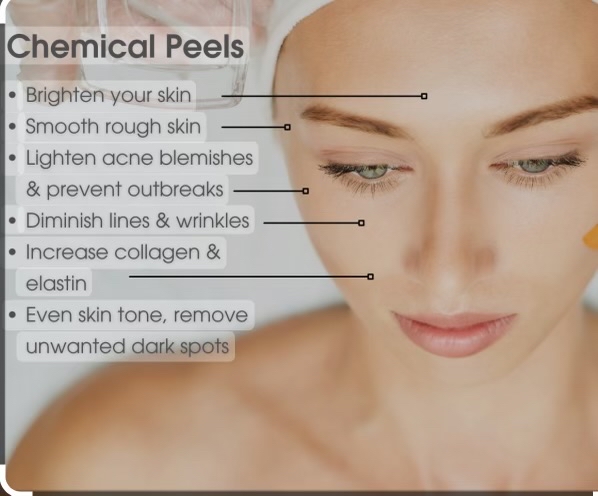 1 Body Chemical Peel