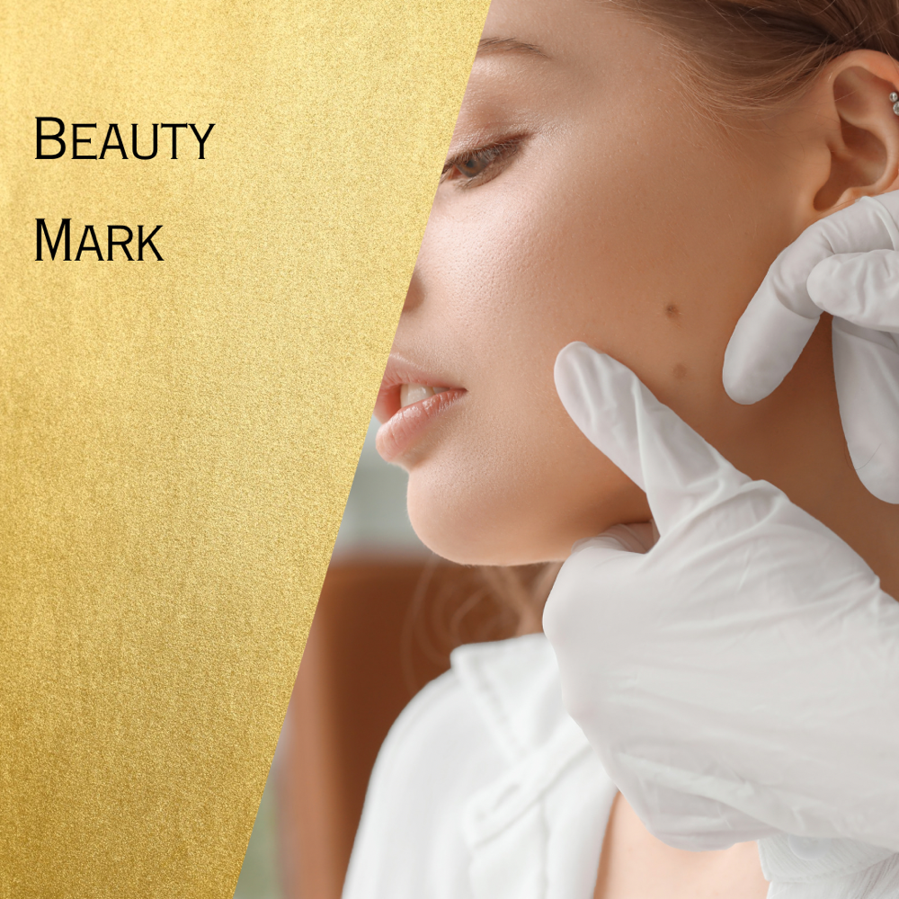Beauty Mark