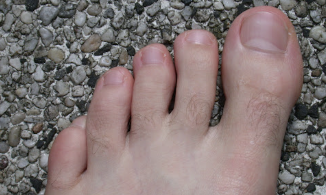 Toe Waxing