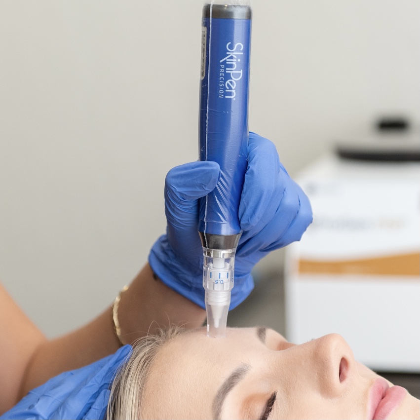 Microneedling with Neck & Decollete