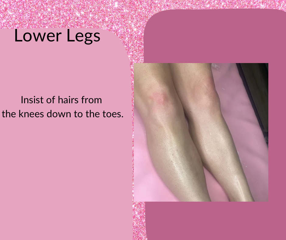 Lower Legs