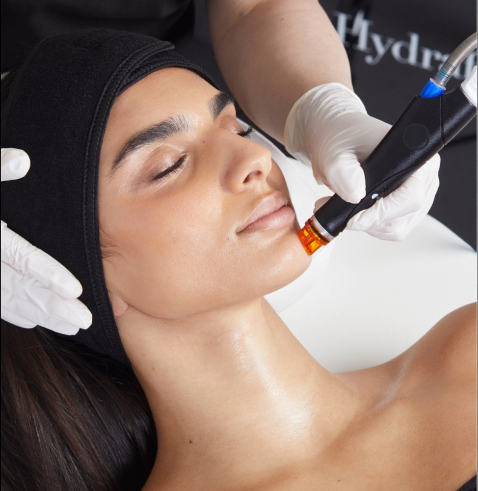 HydraFacial Acne Deluxe