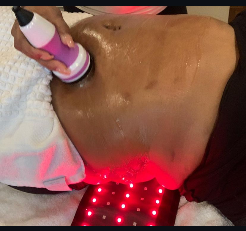 Ultrasonic Cavitation