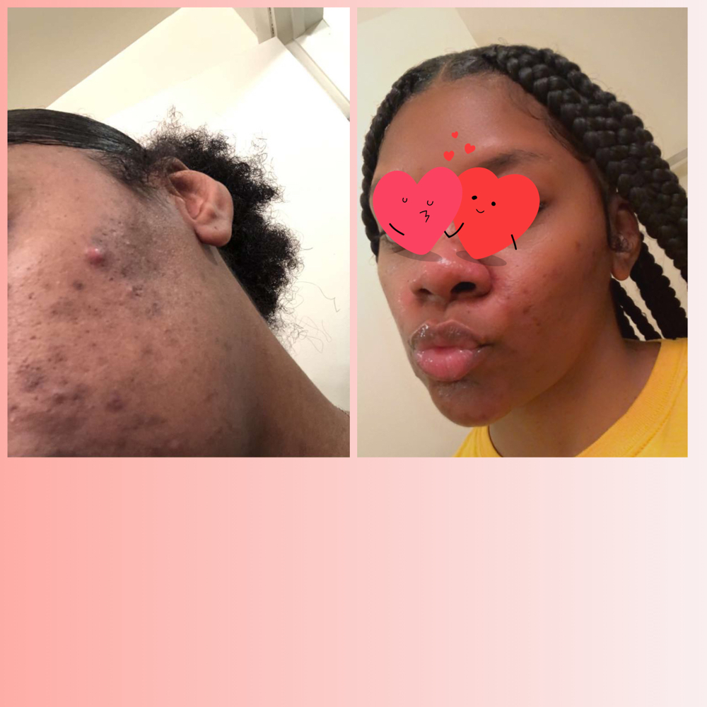 Skin Consultation