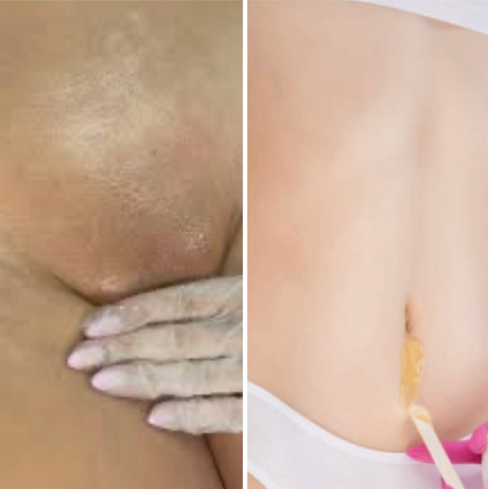 COMBO 2 (Brazilian & Stomach Strip)
