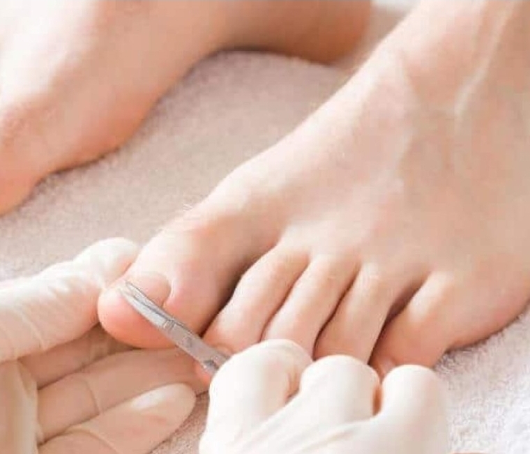 Nail Trim & File: Toes
