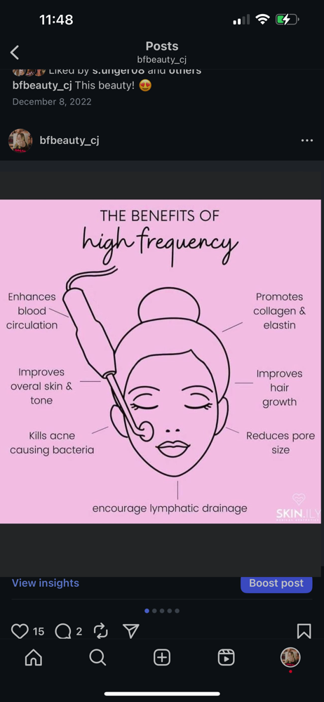 High Frequency facial add on at Butterfly Beauty By Calysta Joy in Warren, MI