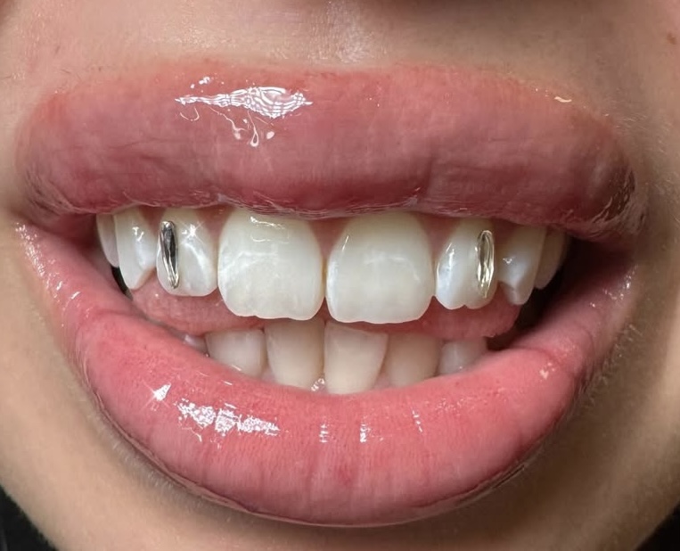 Tooth Gems:Fangs