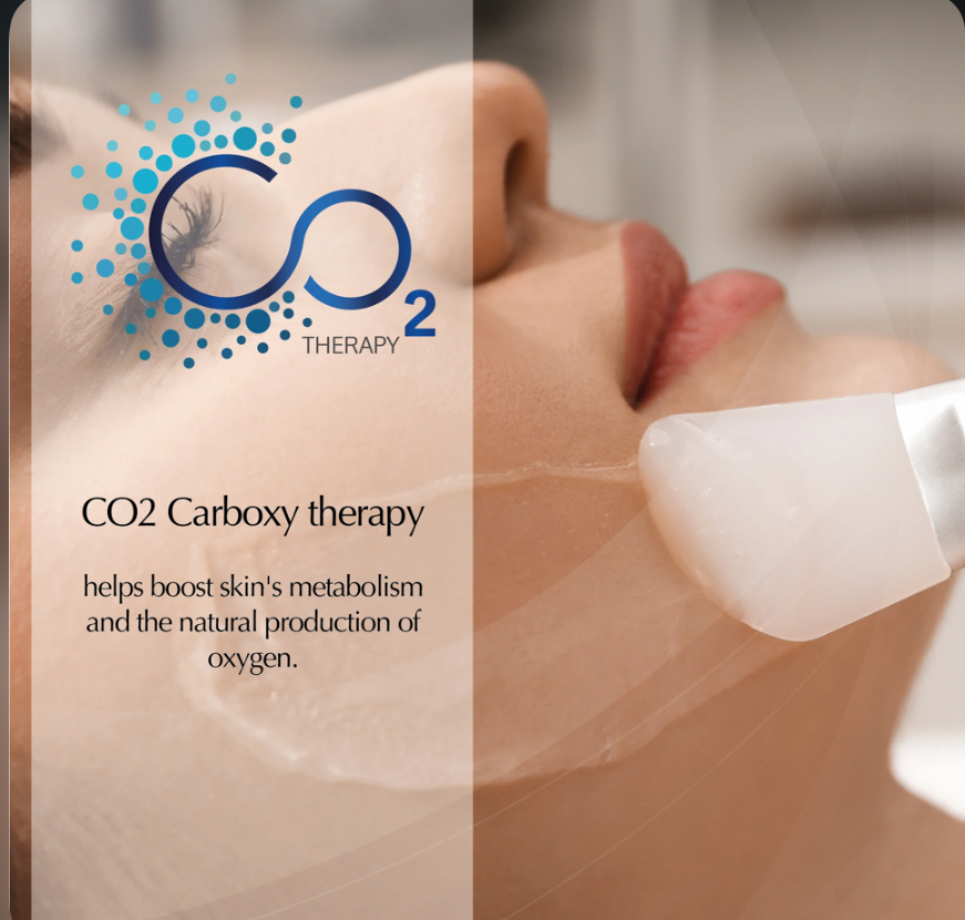 CO2 Carboxy Treatment