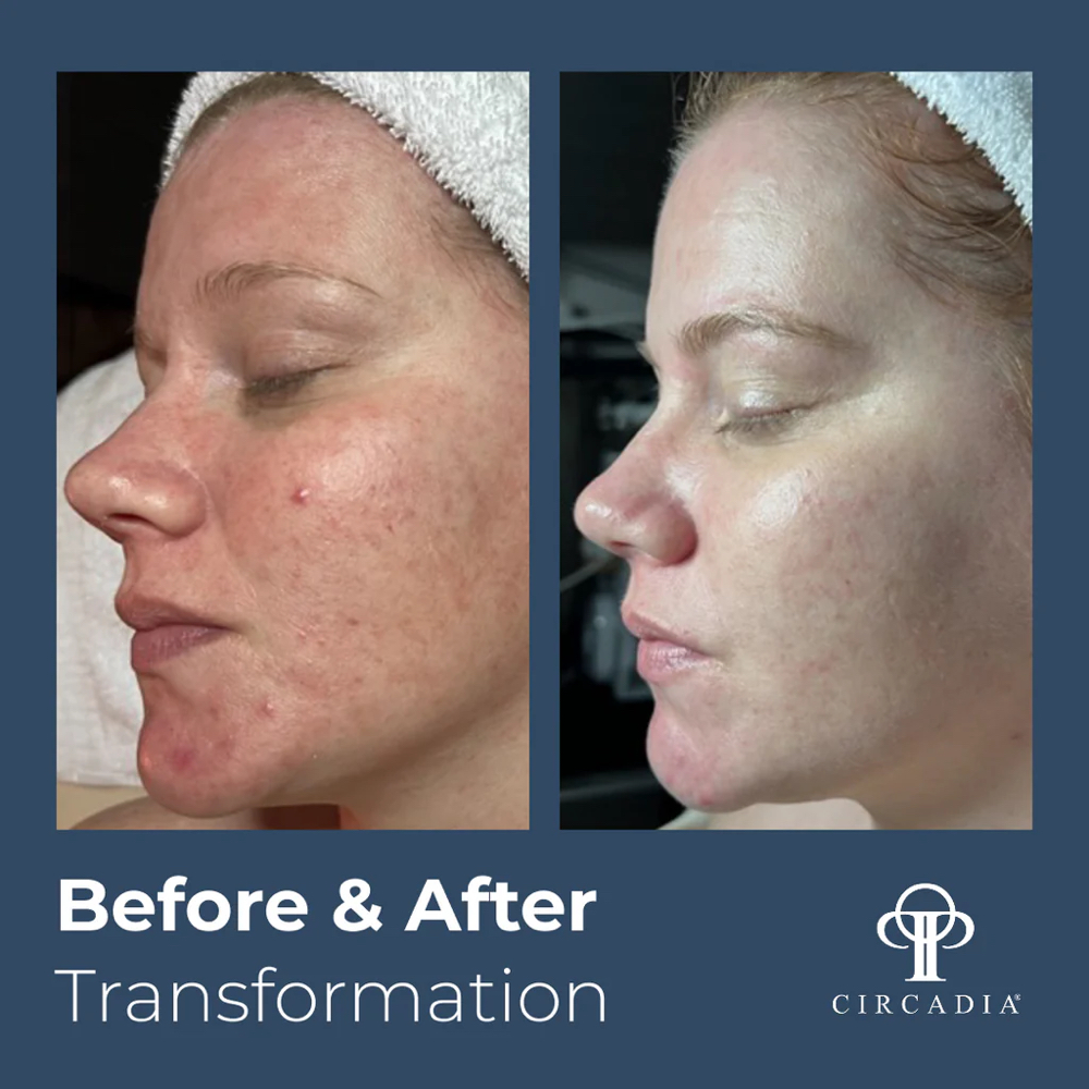 Calming Facial