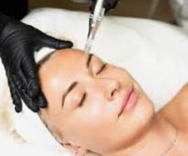 Medical Grade Microneedling at Signature Skin Spa in Scottsdale, AZ