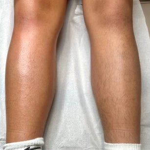 Half Legs at Inclusive Esthetixs in CA, CA
