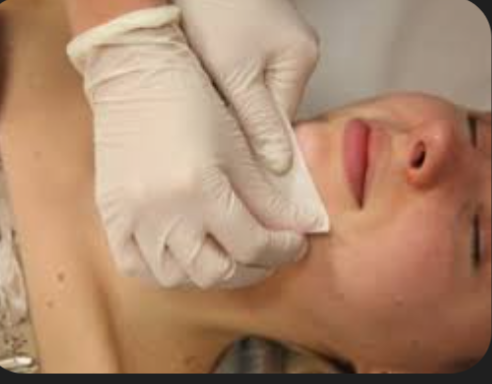 Chin wax
