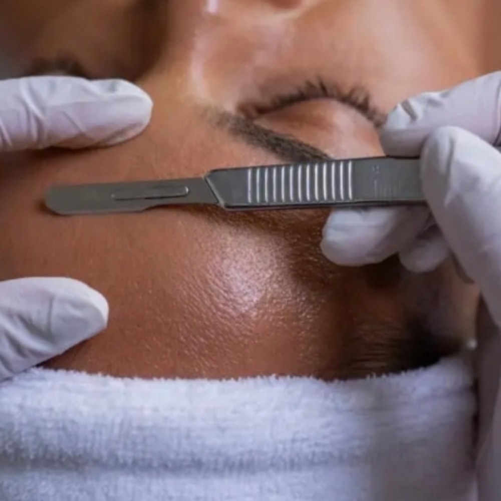 Dermaplaning at Glo Skin Studio in Florence, KY