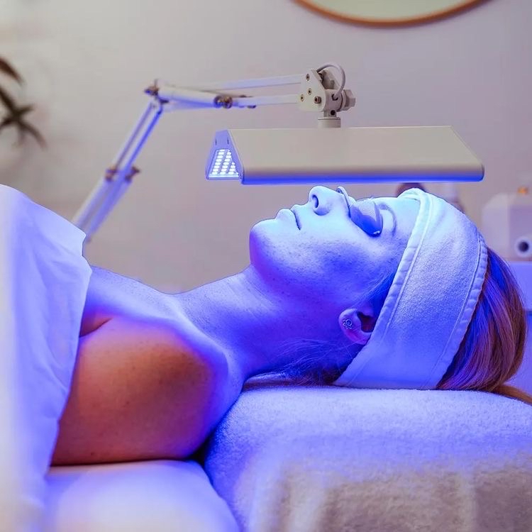 Acne LIGHTWAVE Therapy