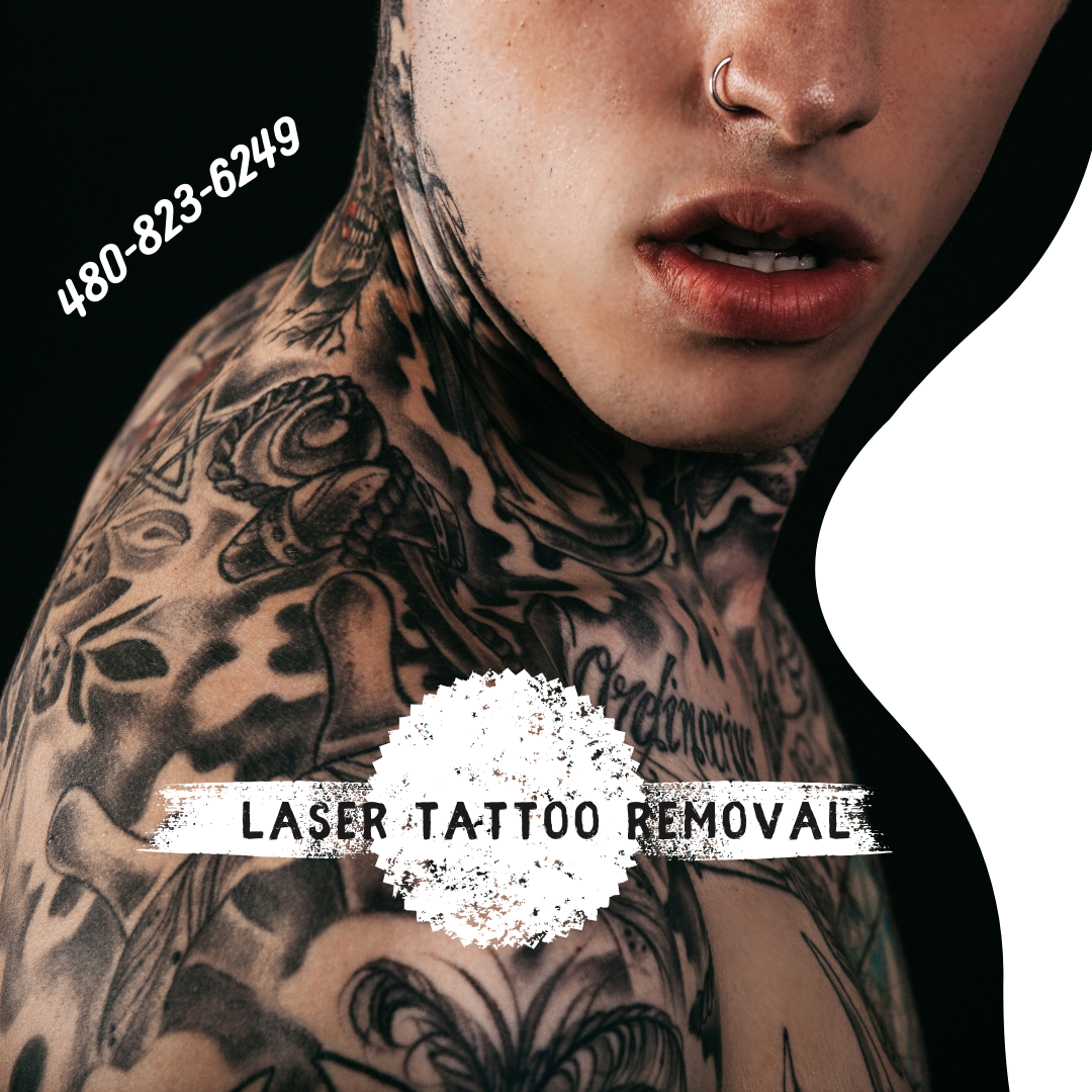 Laser Eyebrow Tattoo Removal