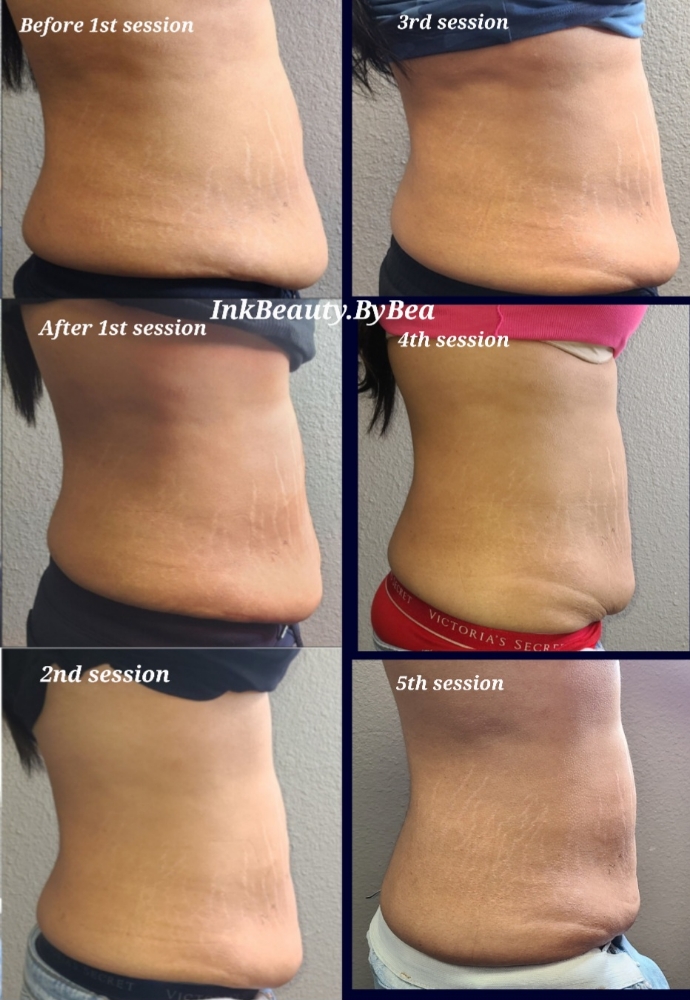 2area 6sessions 1hour 10min
