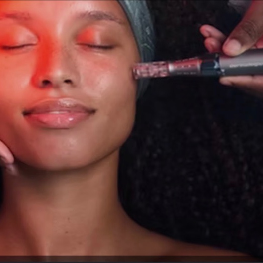 NANO INFUSION at The Skin Lab Aesthetics LLC in Atlanta, GA