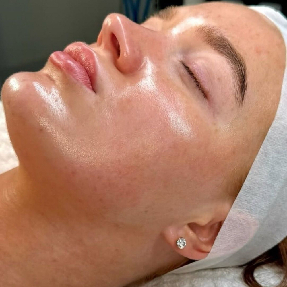 Retinol Radiance Facial at Haylee Jade Esthetics LLC in Ellijay, GA