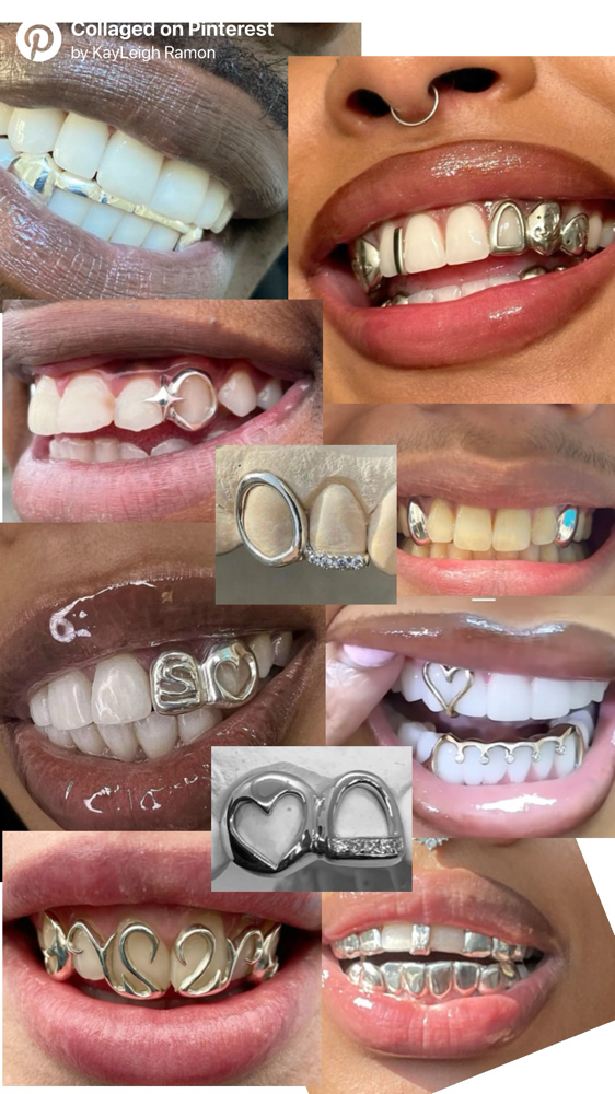 Custom Silver Grillz