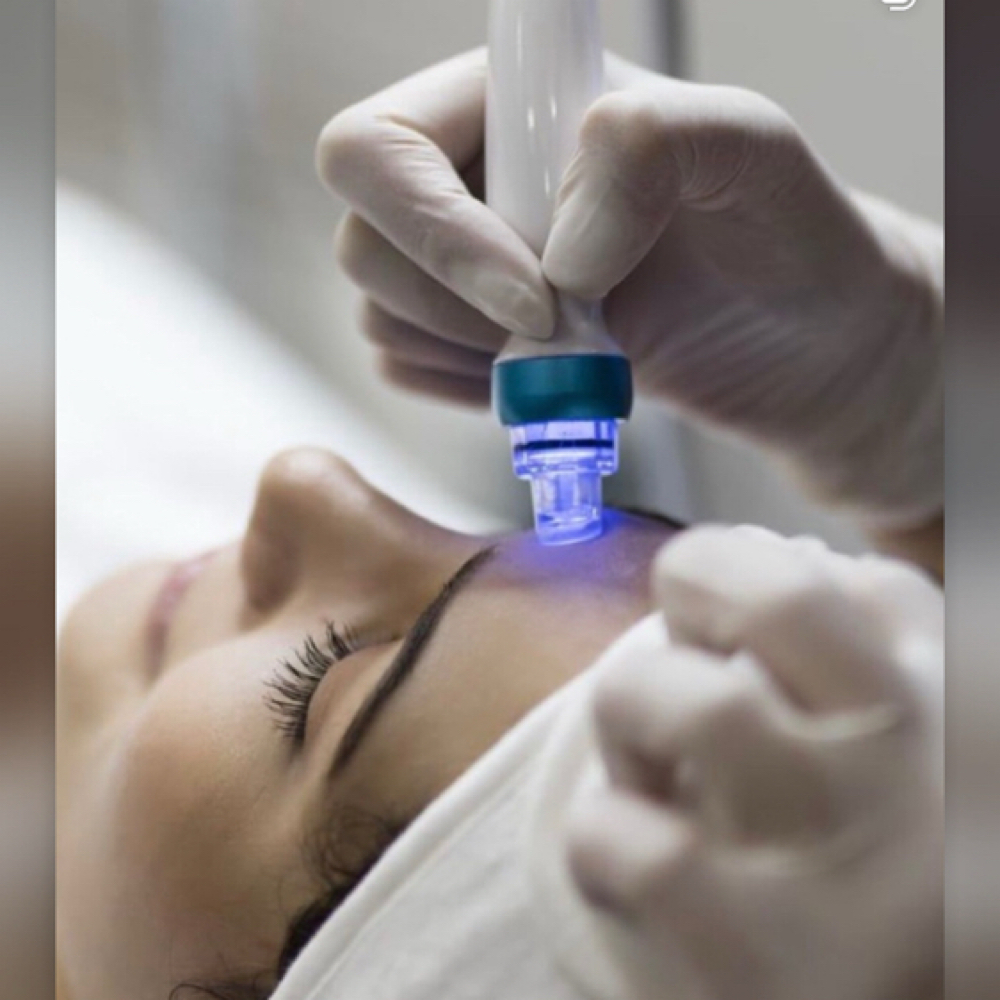 Collagen Induction Therapy at B&G by Tania Loiola in Celebration, FL