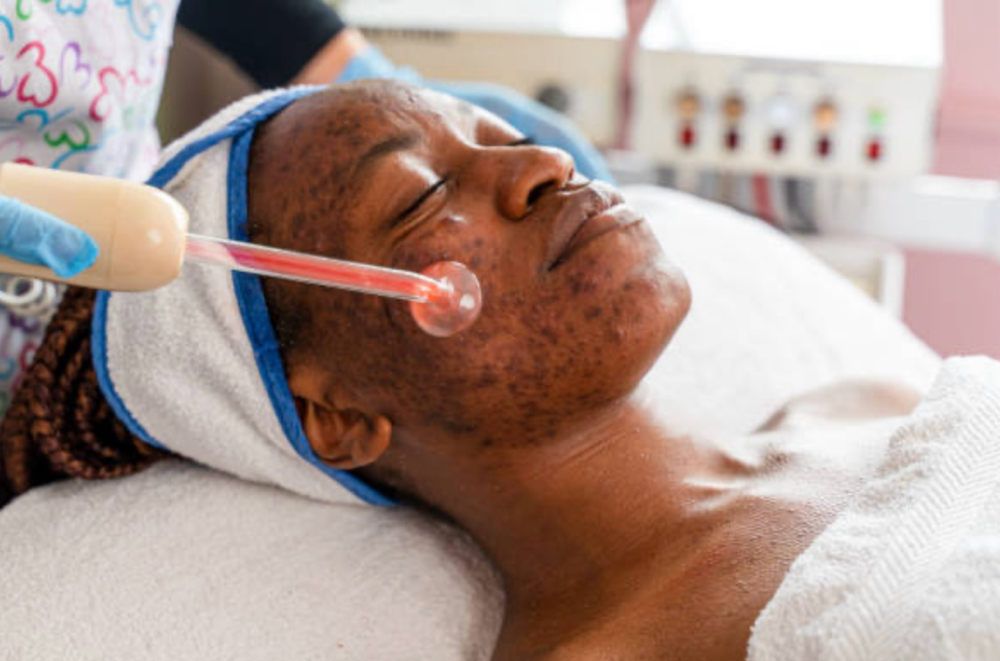 Acne Clearing Facial
