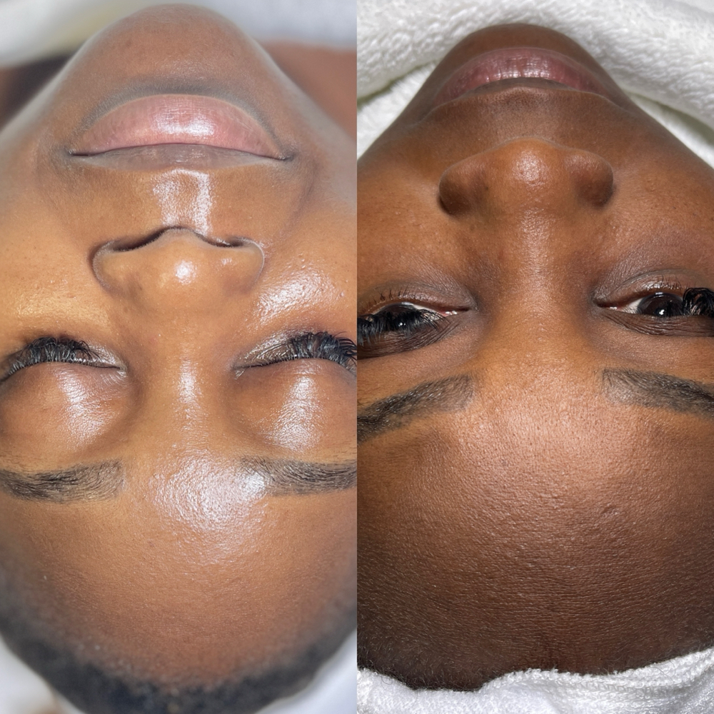 Custom Glowup Facial at Prime Skin  Esthetics in Belleville, NJ