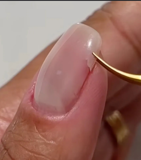 Nail Fix at Aloco. in Fort Myers, FL